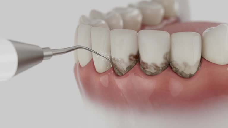 Reliable Dental Implants contractor in Kinsey, AL by Smile Center Dentistry